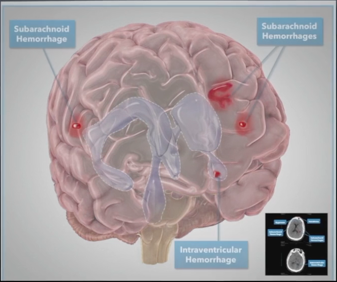 Radiological examination revealed the head trauma suffered: