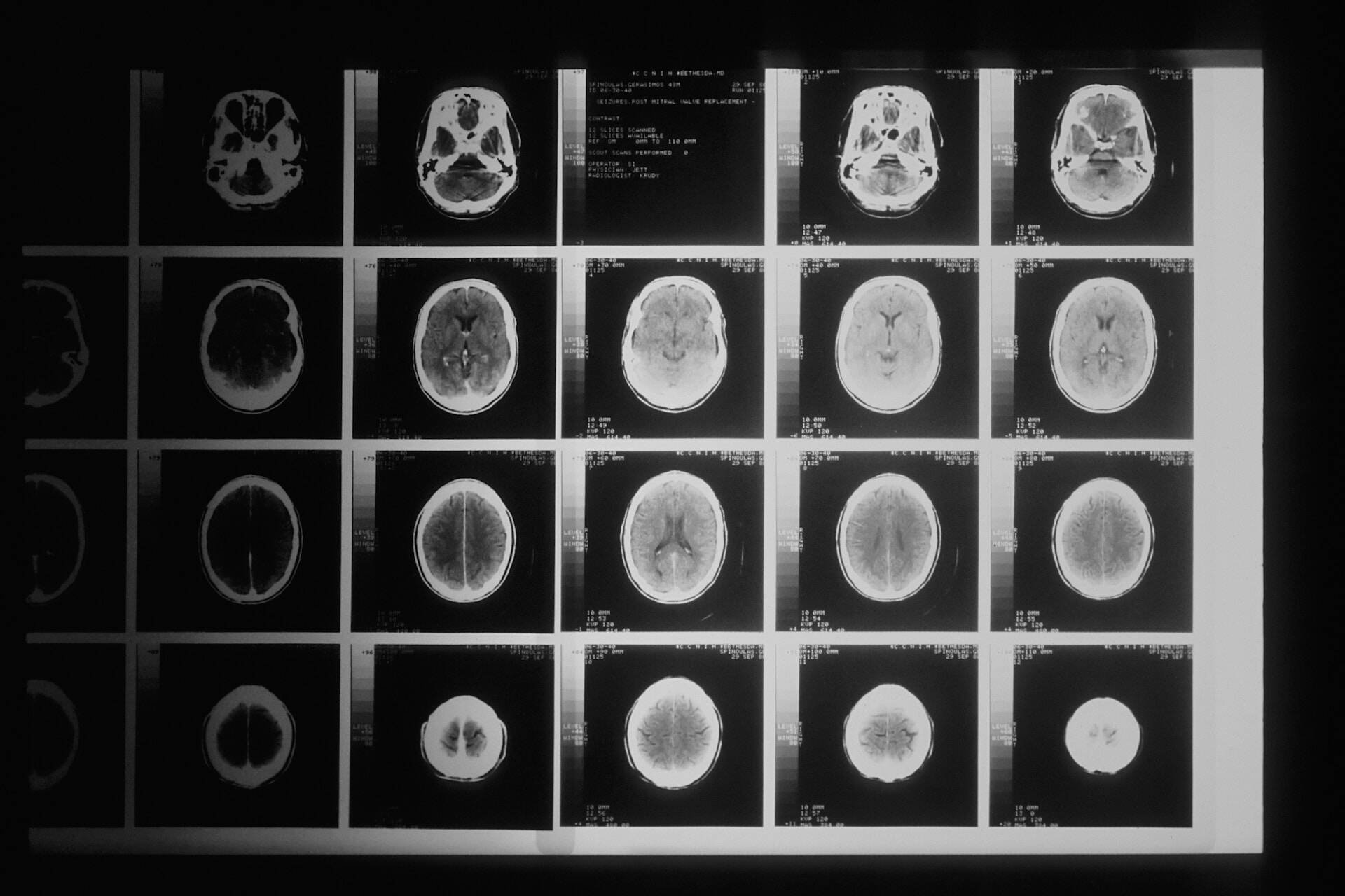 Image of a range of brain scans