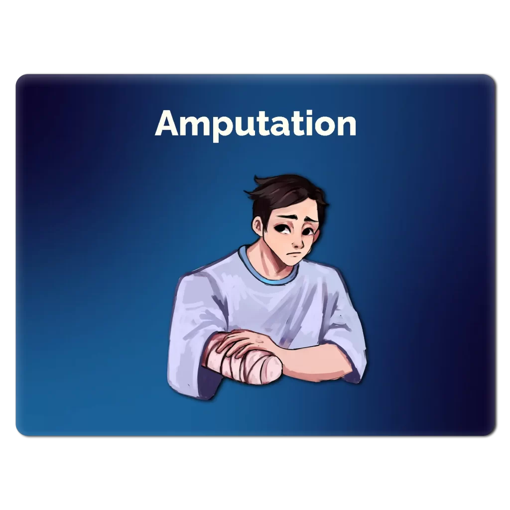 Illustration of a person who has recently had their forearm amputated